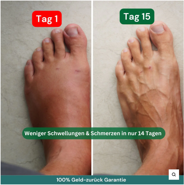 BACKUP2 - VitaLegs™ – Medizinische Kompressionsstrümpfe für leichte & schmerzfreie Beine